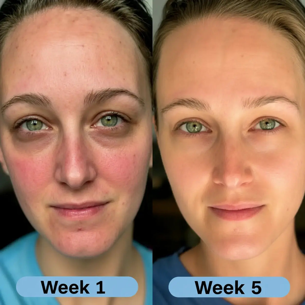 LumiLift® – Korean Collagen Serum for Mature Skin